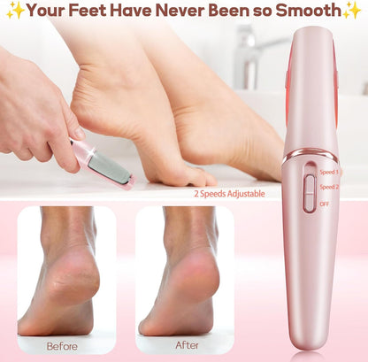 Electric Foot Callus Remover – Rechargeable Pedicure Tool (Pink)